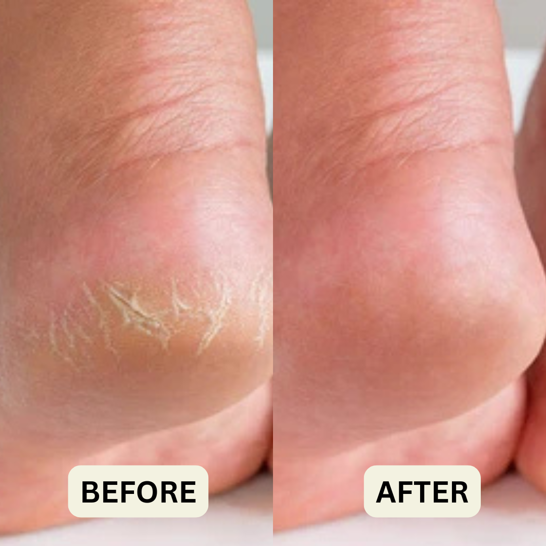 Oluńa Manuka Honey Feet Relief Stick